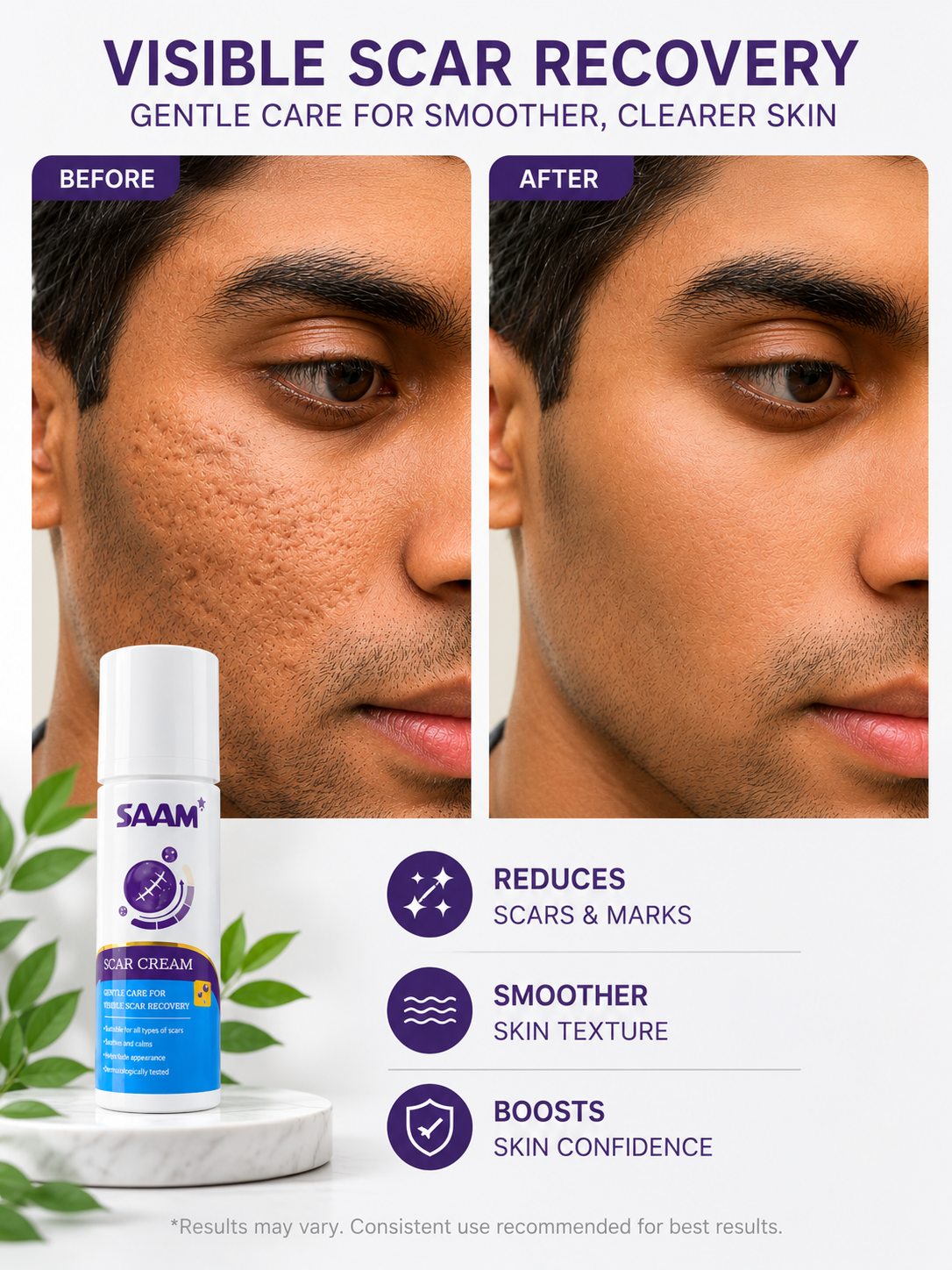 SAAM Scar Cream: Fade Minor Scars & Achieve Even Skin Tone